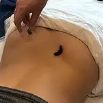 Blutegeltherapie Ausbildung - Exzellenzkurs mit Hanni Hubert